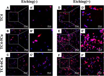 The effect of etched 3D printed Cu-bearing titanium alloy on the polarization of macrophage